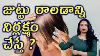 జుట్టు రాలడాన్ని నిర్లక్ష్యం చేస్తే?What Happens if You Neglect Hair Fall Women Alopecia Homeopathy