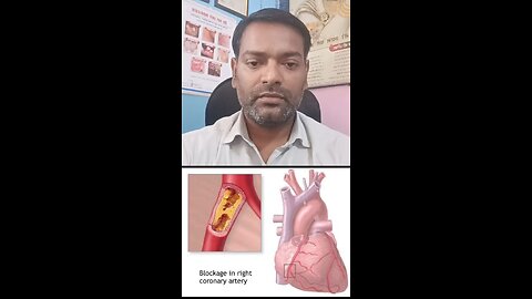 हार्ट ब्लॉकेज ।