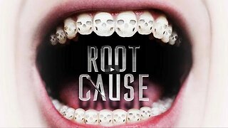 Root Cause: The Truth About Root Canals (Video)