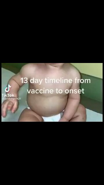 13 day timeline from vaccine to onset.
