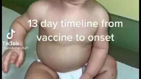 13 day timeline from vaccine to onset.