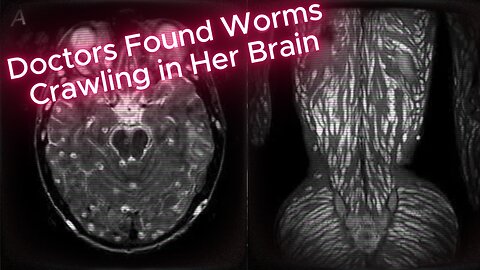 Her Body Was Riddled With Parasites