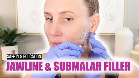 Posterior Jawline & Submalar Filler Education & Safety