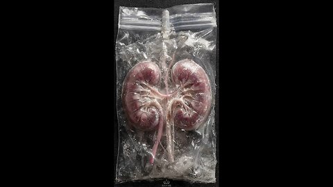 The Kidneys Are Not Just Filters They Are Guardians Of Balance, Chemistry & Life Itself ❤️
