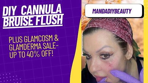 DIY Cannula Bruise Flush + up to 40% off @ Glamcosm/ Glamderma (ends 31 Jan)