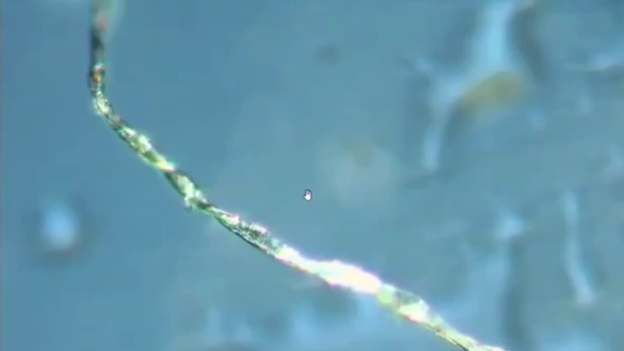 A microscopic examination of nanobots and hydrogel structures developing in vaccinated individuals.