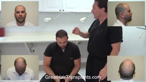 Dr. Brett Bolton | Patient Adrien’s MaxHarvest™ Plus Transformation