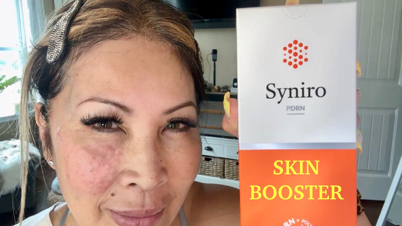 SYNIRO PDRN SKIN BOOSTER DOING MESOTHERAPHY #over60 #acecosm