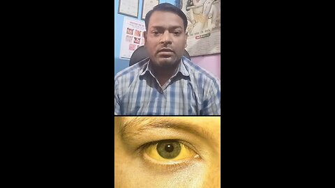 पीलिया में यह जांच कराएं ।