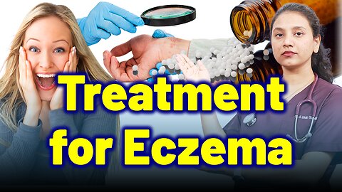 Best Treatment for Eczema | Treatment Cure Relief Medicine | Skin Hair Nail | Homeopathy