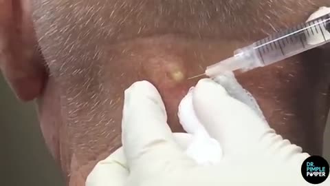 A Nice Whitehead on the Neck OFFICE POP FLOP