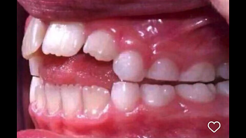 iits a celebration !! chirpbol1 on twitch/rumble , chirpbol on youtube/kick/tiktok/facebook