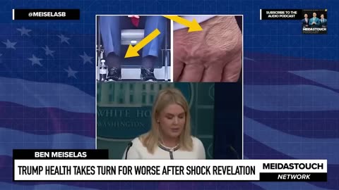 Trump Health TAKES TURN FOR WORSE after SHOCK REVELATION