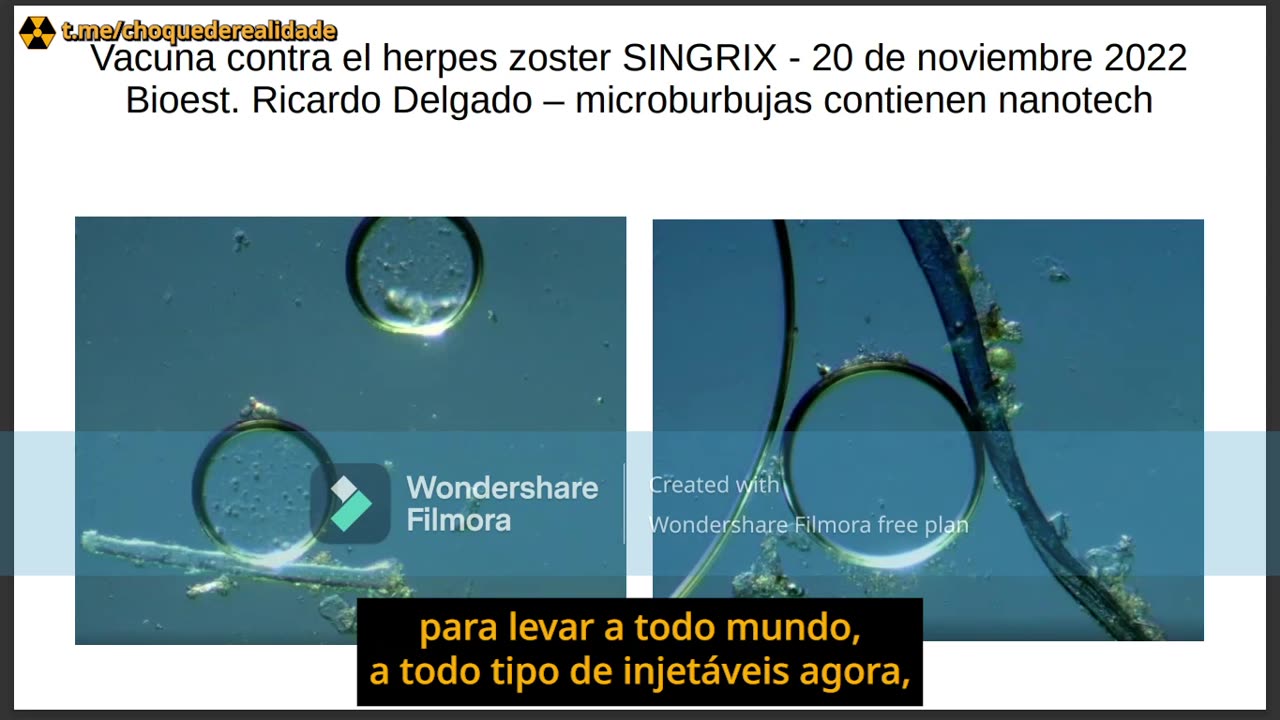 Várias Vacinas com grafeno e nanotecnologia