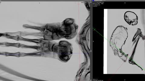 👽🔍 Maria's Feet Scans: Manipulation or Truth? | TheTruthAbove