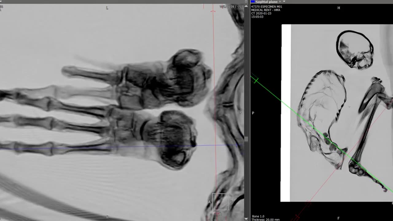👽🔍 Maria's Feet Scans: Manipulation or Truth? | TheTruthAbove