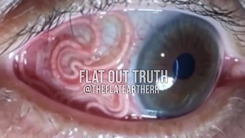 Vril, or Parasite Infestation?