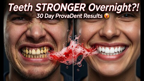 ProvaDent Dental Foam REMINERALIZES Teeth Overnight? 😱 My SHOCKING 30-Day Results (Before & After!)