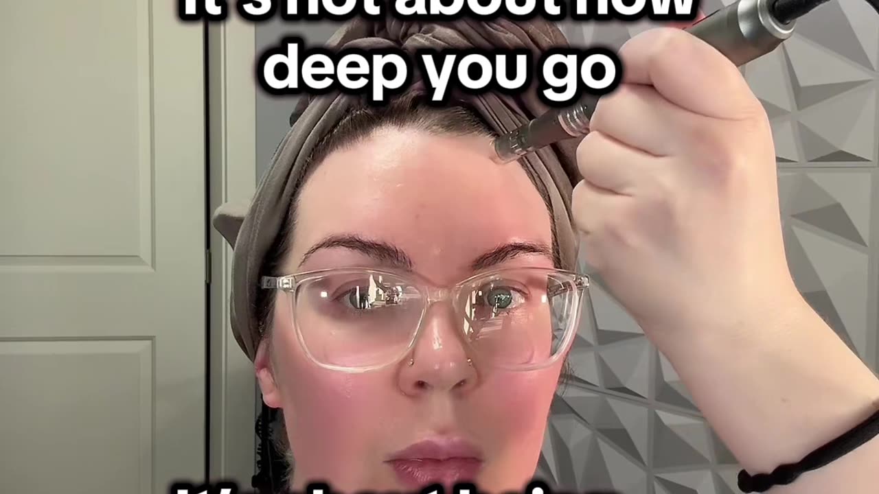 MICRONEEDLING - CONSISTENCY IS KEY