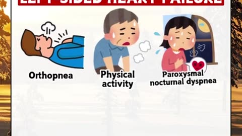 Top 9 shortness of breath symptoms of Left-Sided Heart Failure