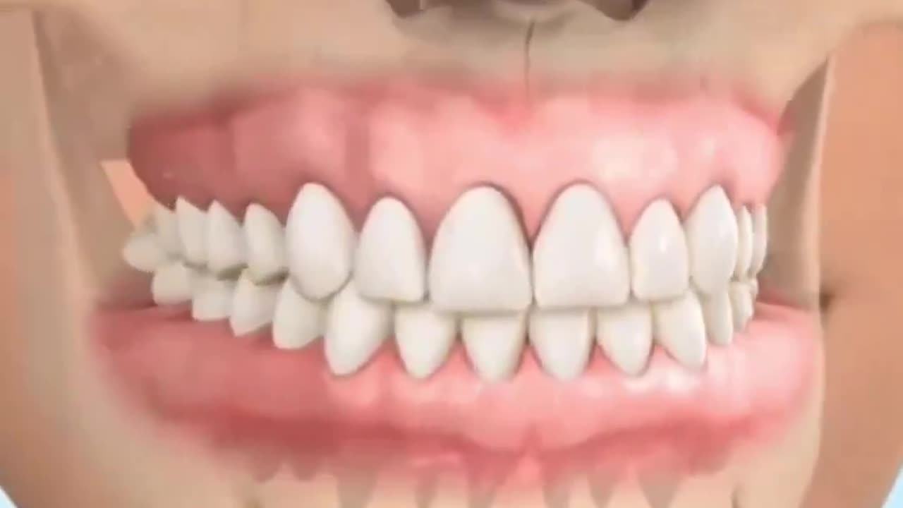 How braces work and how they change your face