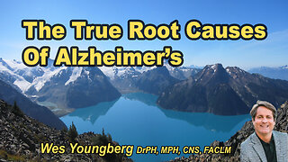The true root causes of Alzheimer’s disease