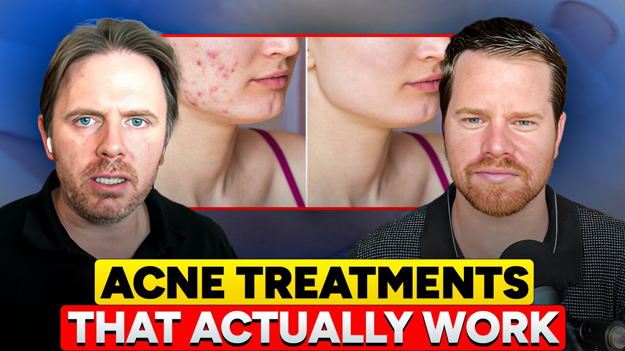 Best Natural Skincare for Acne: What Actually Works (Inside + Outside)
