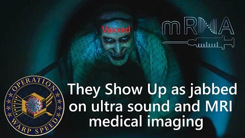 COVID 19 Vaccinated show up on MRI, Ultra Sound, & CT Scan medical imaging - Mark of the Beast
