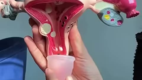 Menstrual cup #hospital #rakshitasingh #mbbsstudent #doctor #ytshorts #trending #neet #study