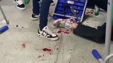 Schoolgirl repeatedly stabbed in face with pen during fight