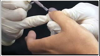 Doctors warn of gel manicure dangers 2018