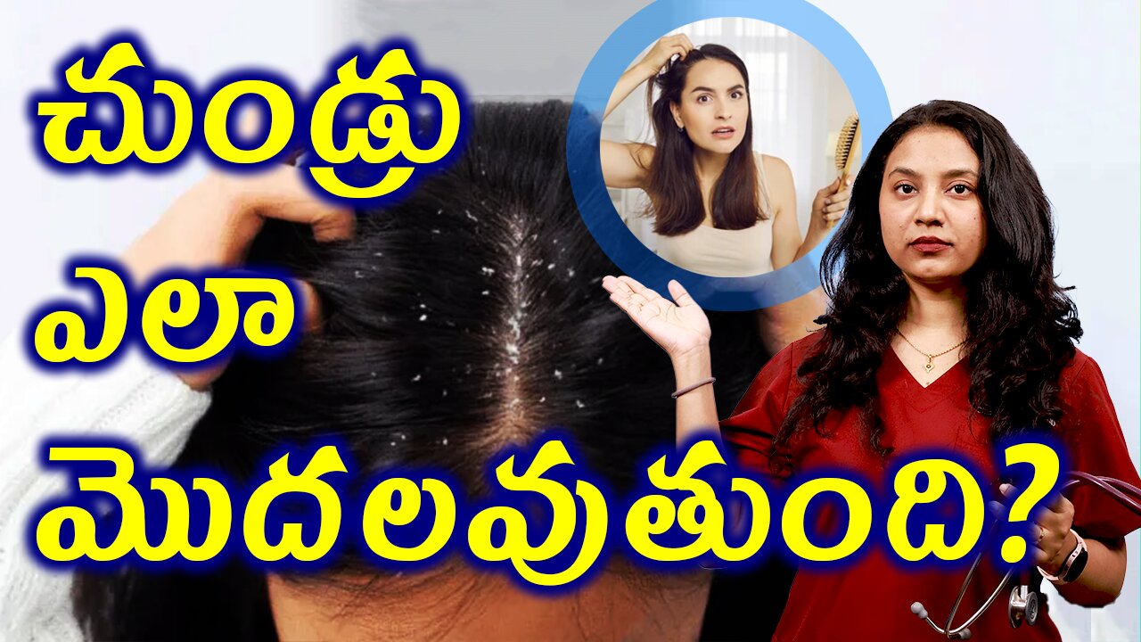 చుండ్రు ఎలా మొదలవుతుంది? Signs and Symptoms of Dandruff Treatment Solution Cure | హోమియోపతి