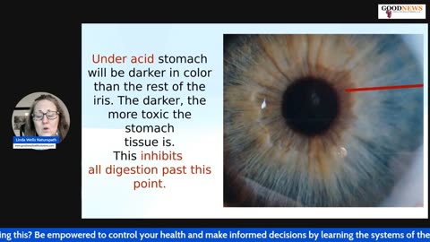 Is Your Stomach Producing Enough Acid to Digest Food?