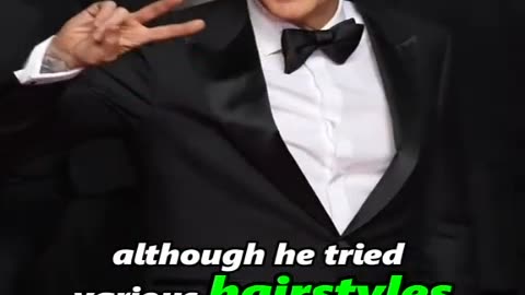 5 celebrities who have to wear wigs because of health issues