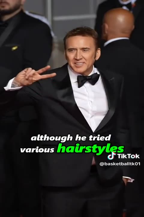 5 celebrities who have to wear wigs because of health issues