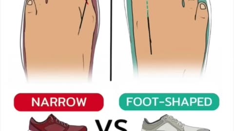 Shoes are destroying your feet