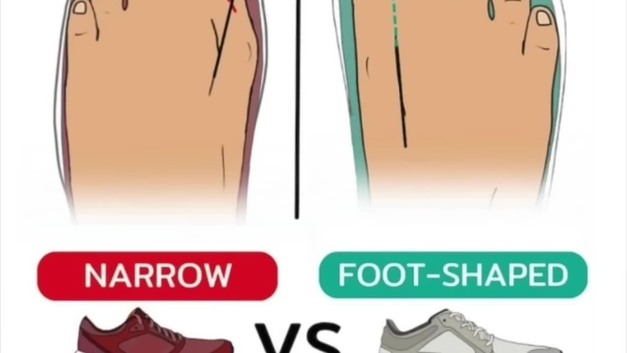Shoes are destroying your feet