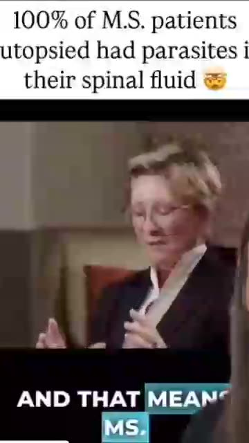 100% of the MS patients autopsied had parasites in their brain and spinal fluid!!