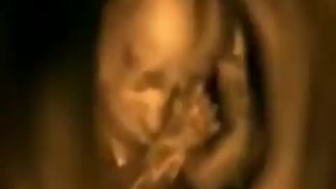 WOW! Incredible Scan of Unborn Baby!