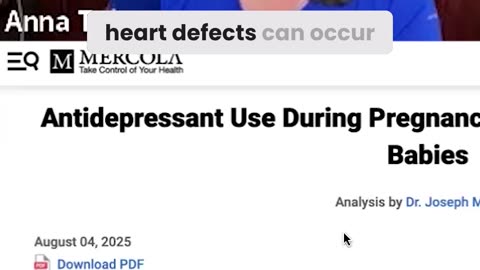 SSRIs and Birth Defects
