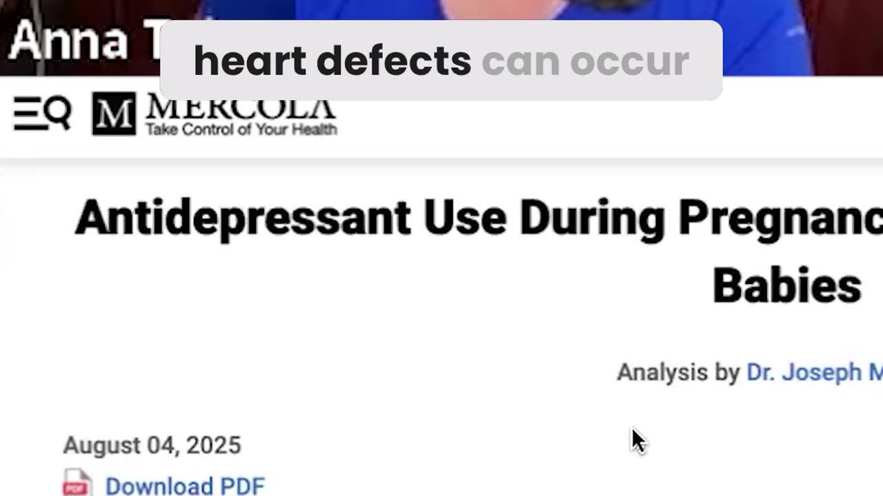 SSRIs and Birth Defects