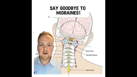 Migraines and the top of your neck | Neckwise Upper Cervical Chiropractor