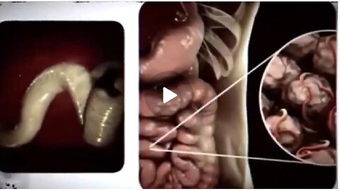 PARASITES|DEMONS & VIBRATIONS | THE TRUTH ABOUT PARASITES 💣