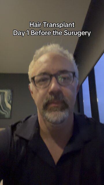 Hair Transplant Day 1