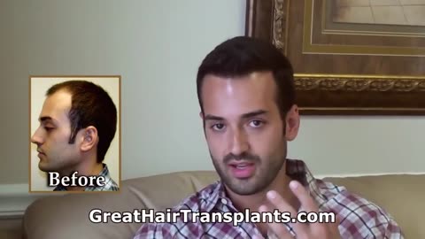MaxHarvest™ Hair Transplant – Amazing Results by Dr. Brett Bolton