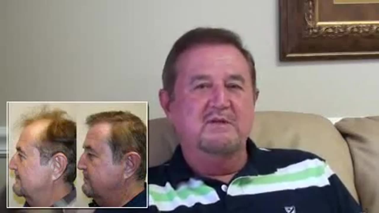 Yet Another Happy Patient Thanks to Dr. Brett Bolton’s MaxHarvest™ Procedure