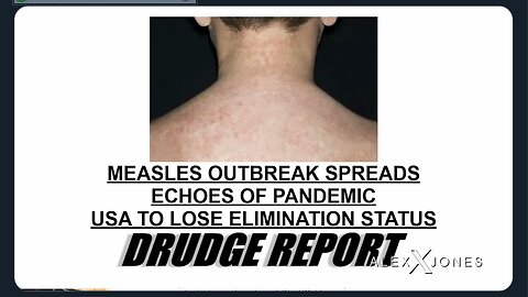 Cornered Democrats/Big Pharma Launch New Measles Pandemic Hoax