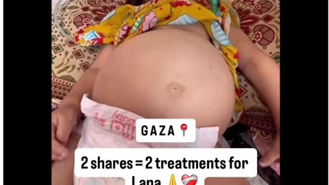 REP RITCHIE TORRES NY 15TH DISTRICT $1,528,000 AIPAC HORE