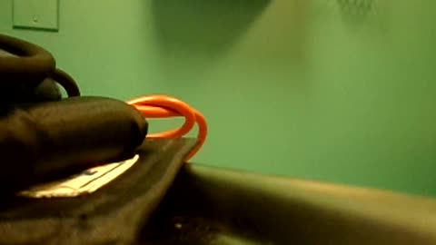 Bnkywuv talks to nurse about hearing a voice say 'what a beautiful world' during blood draw