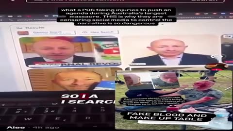 Here’s the crisis actor of the Bondi Beach false flag in all his fake blood glory